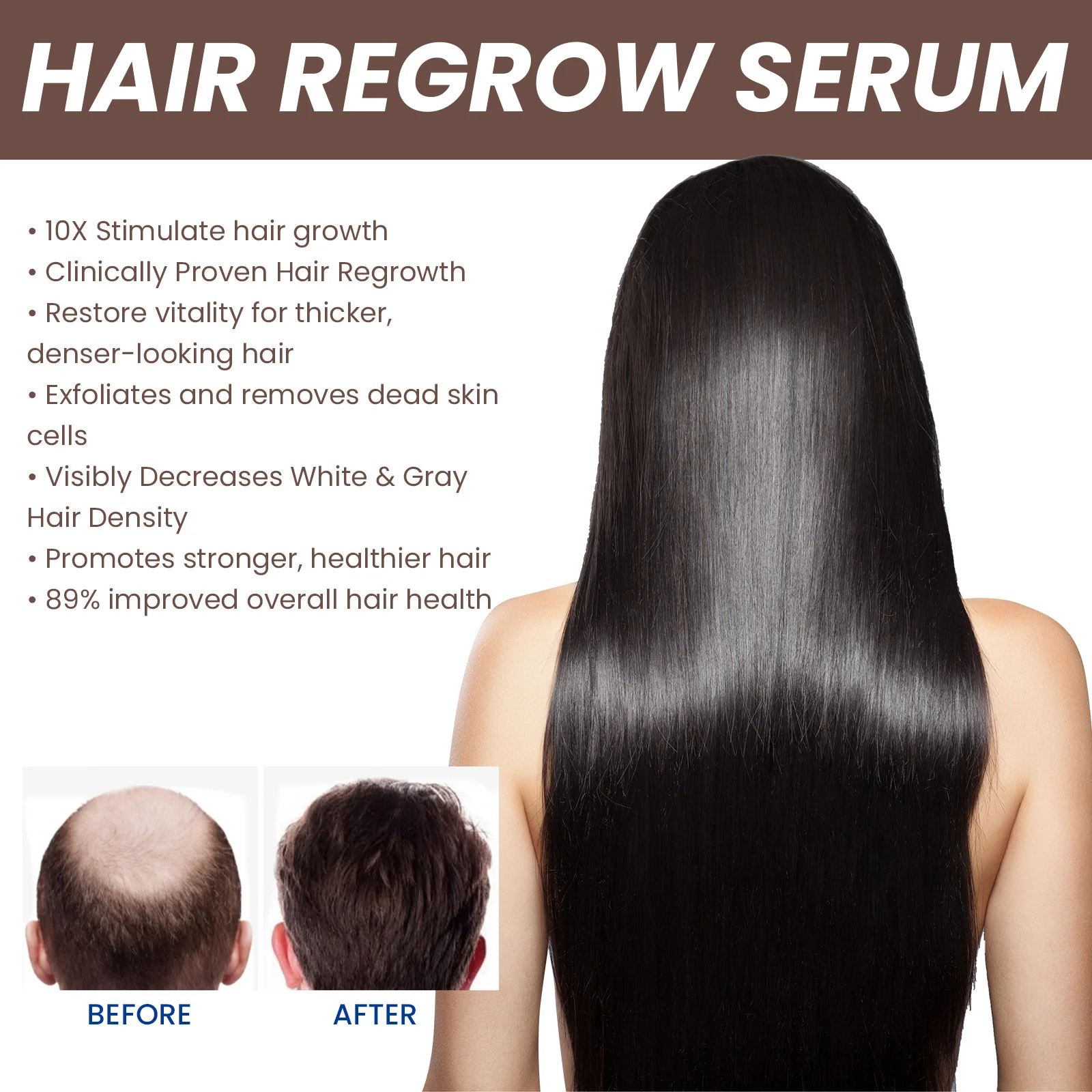 EELHOE Hair Dense Essence Hair Anti-hair Loss And Hair Fixation Nutrition - Image 3