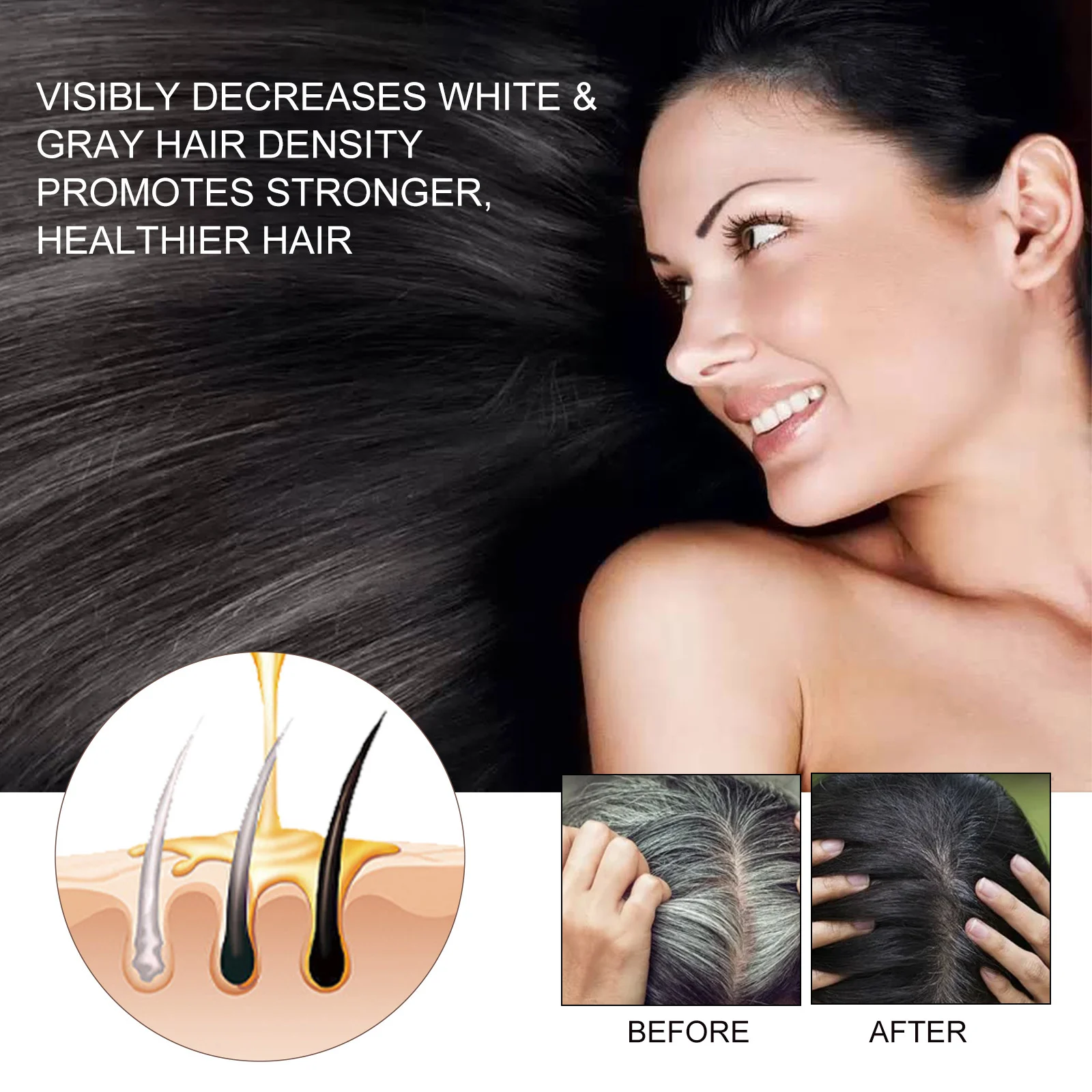 EELHOE Hair Dense Essence Hair Anti-hair Loss And Hair Fixation Nutrition - Image 2
